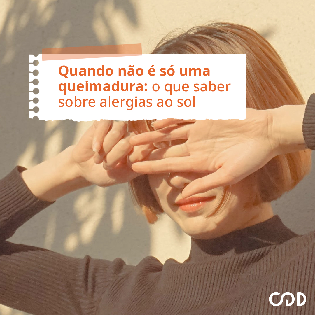 Quando não é só uma queimadura: o que saber sobre alergia ao sol